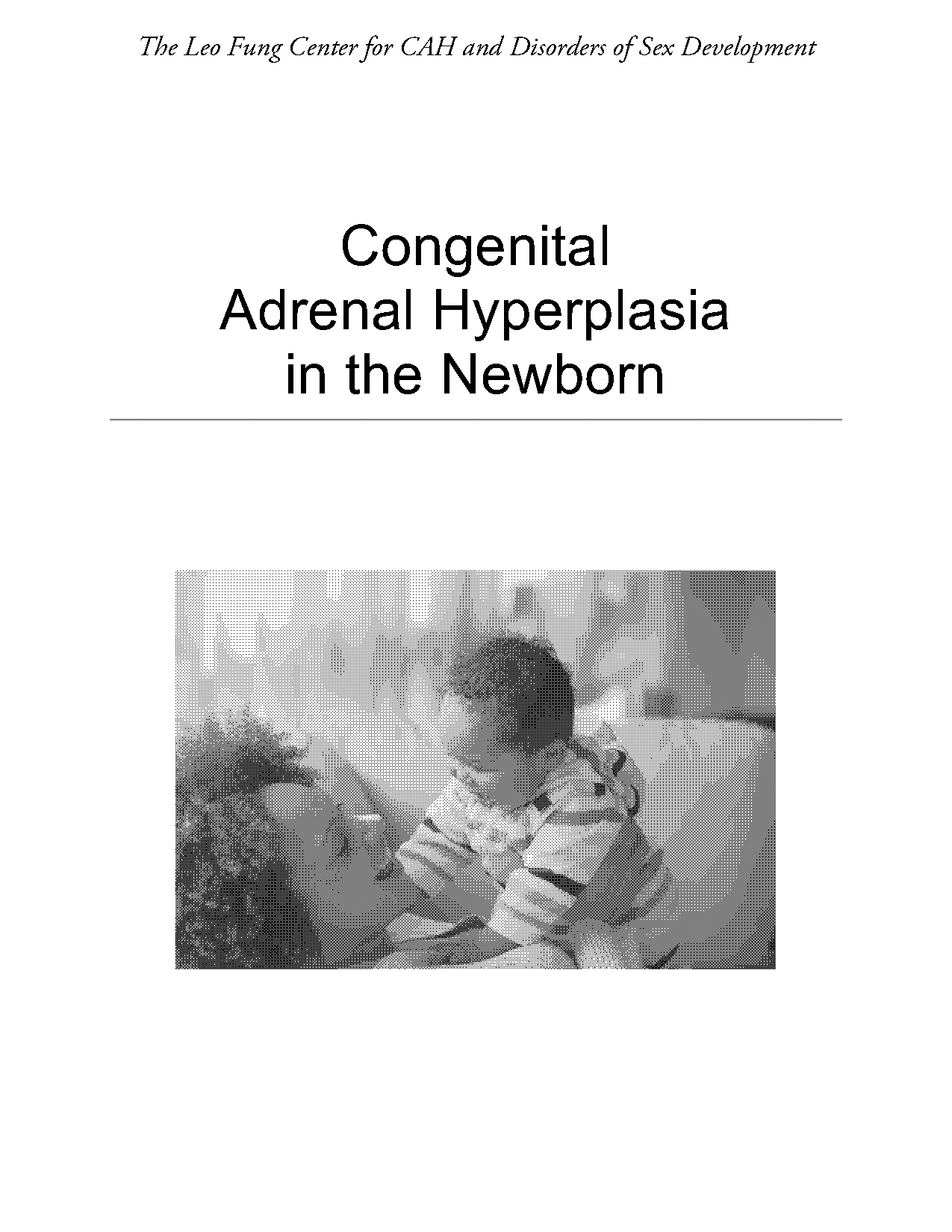 hyperpiesia medical term definition